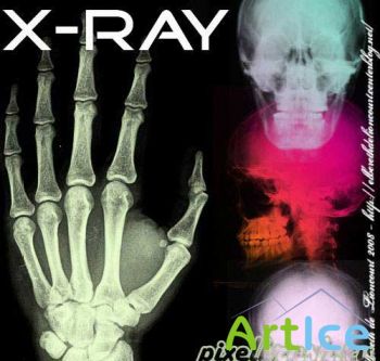  X-RAY