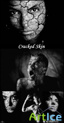 Cracked Skin - Stock Photos